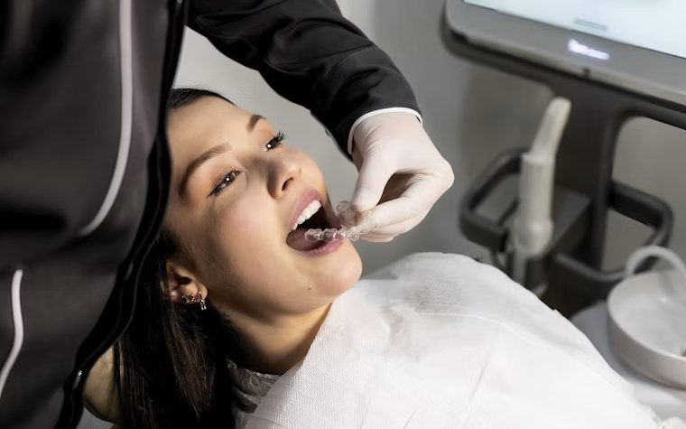 Clinician fitting a clear aligner during a dental appointment
